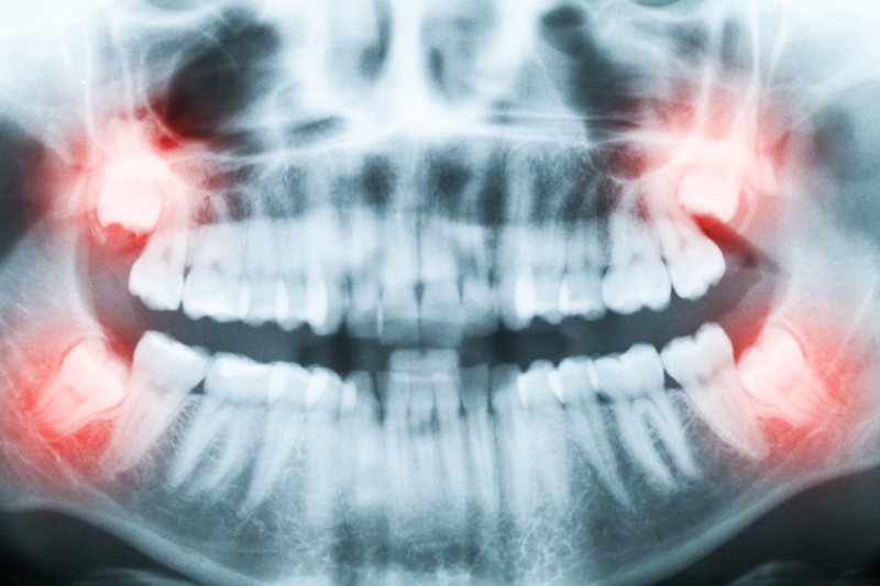 banner-image